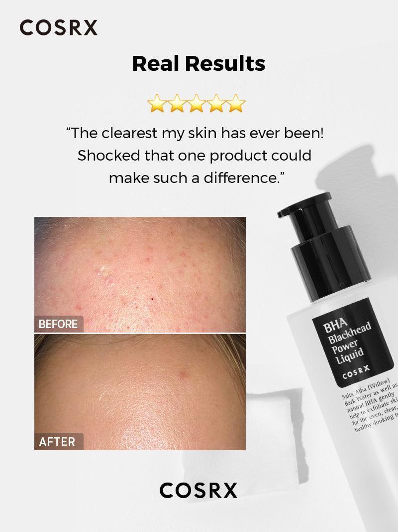 COSRX
 BHA Blackhead Power Liquid Treatment